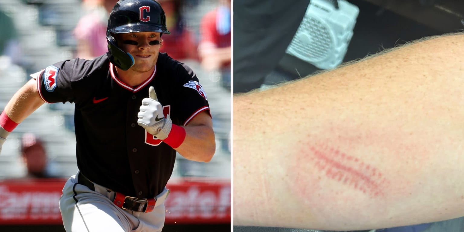 Travis Bazzana takes Jose Ramírez line drive off the arm in Guardians’ 4-3 win over Angels
