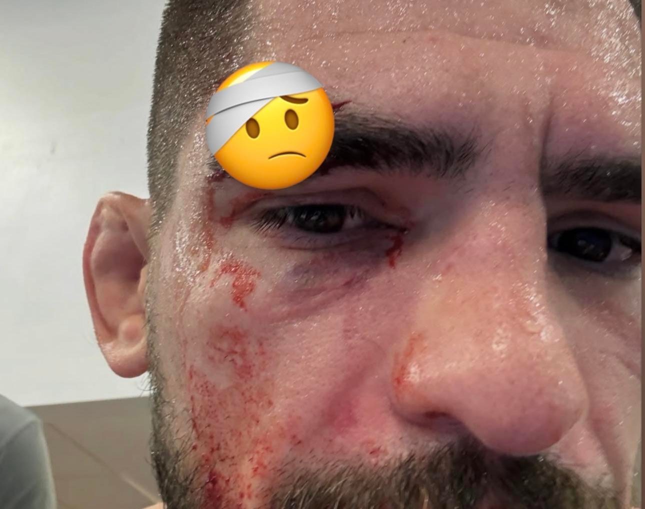 Gaston Bolanos withdraws from UFC Vegas 123 bout days after Halloween card fixture locked in