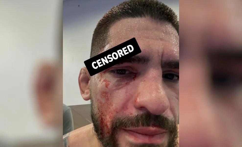 UFC featherweight fight added to Halloween card after grisly cut
