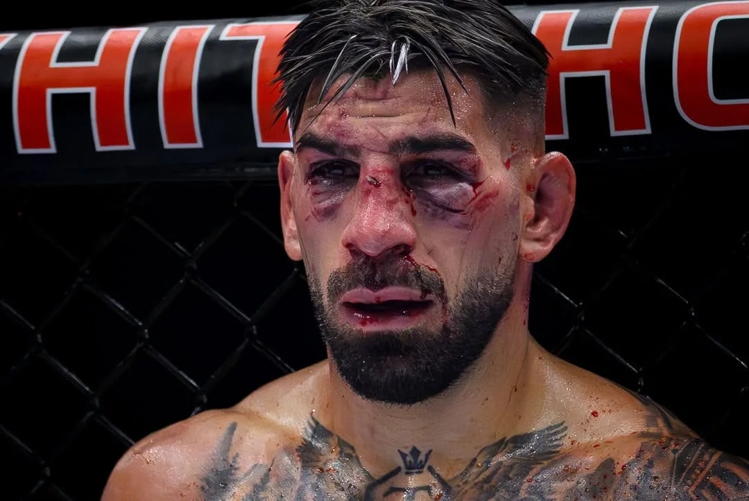 Islam Makhachev says Ilia Topuria’s Justin Gaethje loss can be a turning point, not a setback