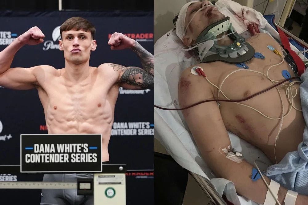 UFC hopeful Liam McCracken describes a 2023 bus attack and the moment he realized he had survived